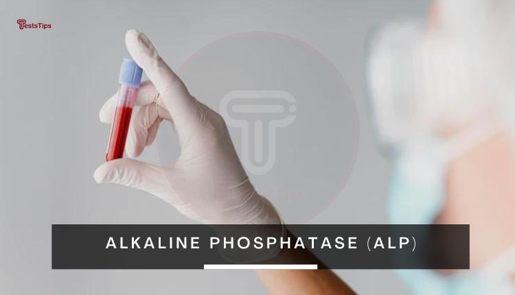 Alkaline Phosphatase (ALP)