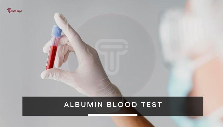Albumin Blood Test