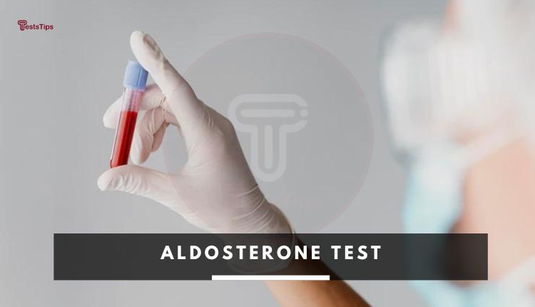 Aldosterone Test