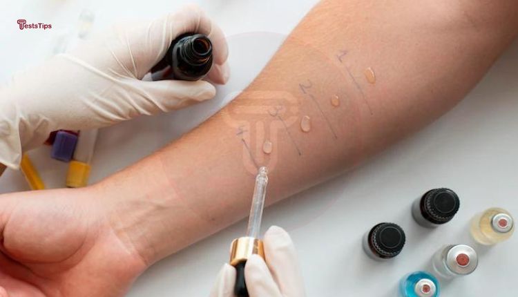 Allergy Skin Test - allergy scratch test.