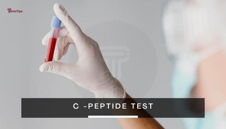 C peptide test
