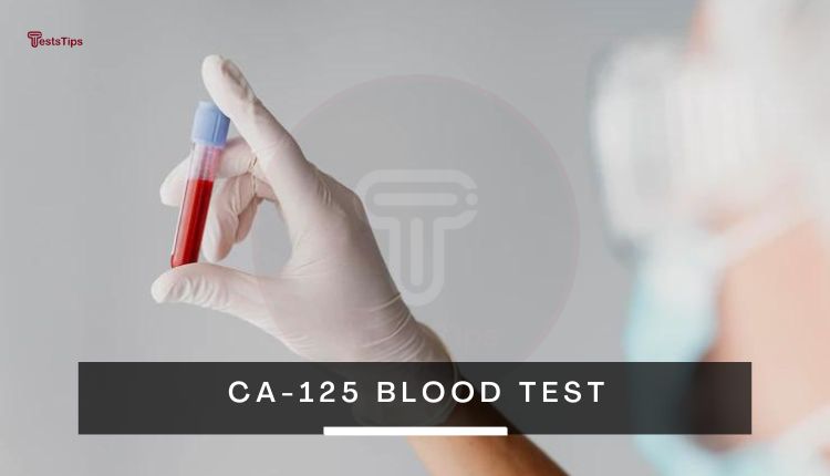 CA-125 blood test