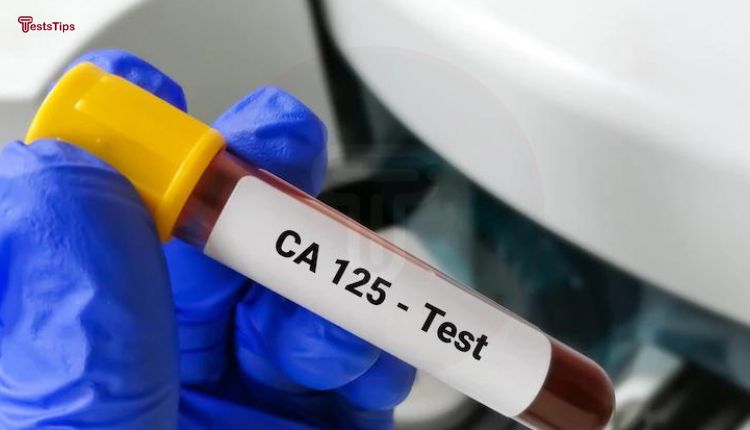 CA-125 blood test