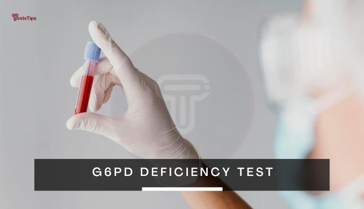 G6PD deficiency test