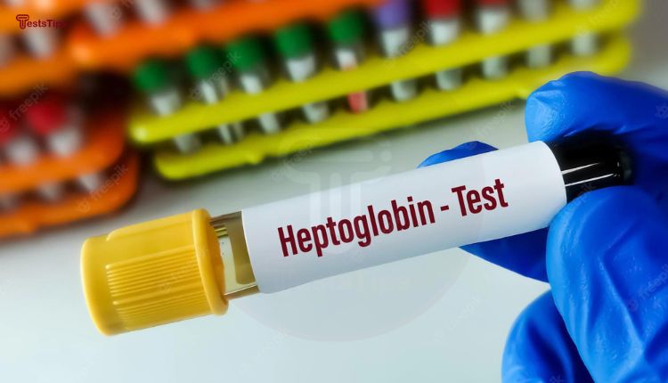 Haptoglobin test