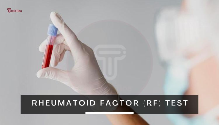 Rheumatoid Factor (RF) Test