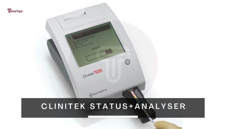 CLINITEK Status Urine Chemistry Analyser