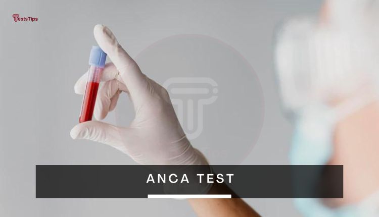 ANCA test