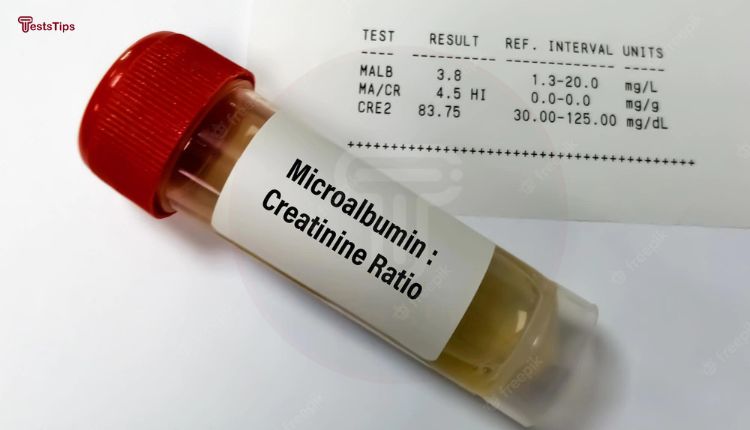 Microalbumin Creatinine Ratio