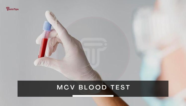 MCV Blood Test