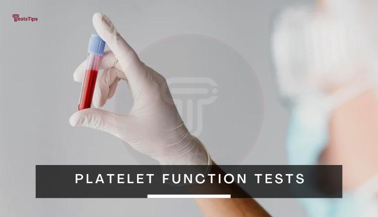 Platelet function tests