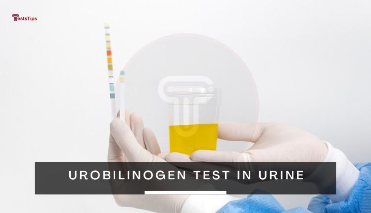 Urobilinogen Test In Urine