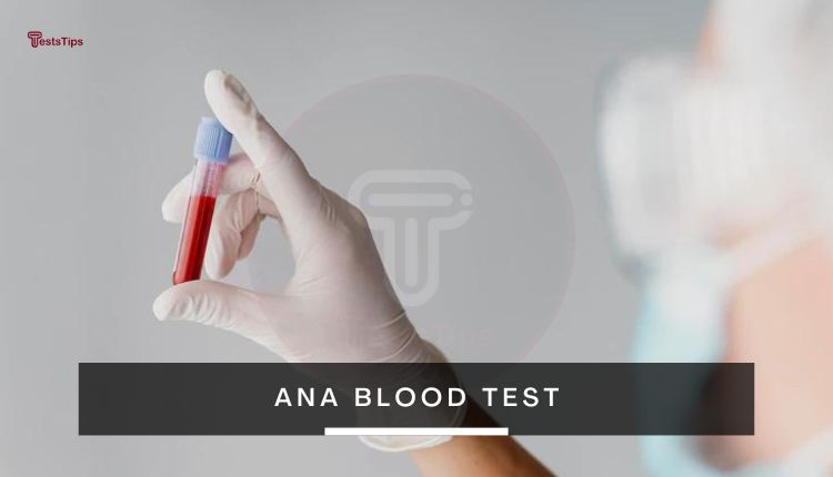 ANA Blood Test