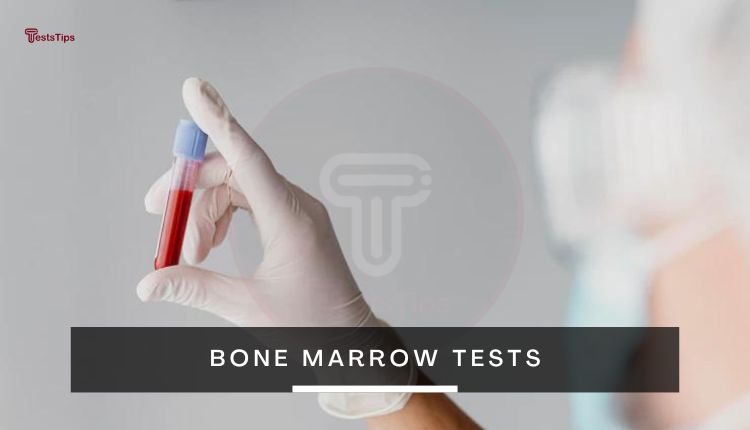 Bone marrow tests